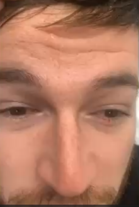 Anti-Wrinkle Treatment in Liverpool